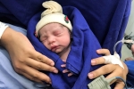 baby born in Brazil, baby born in Brazil, first baby born after dead womb transplant, Gynecology