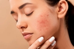 dermatologist, skin, 10 ways to get rid of pimples at home, Swimming